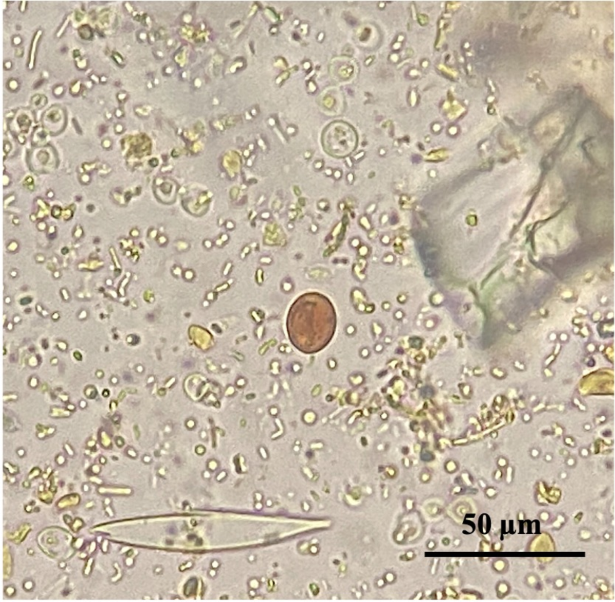 Enhancing diagnostic accuracy: Direct immunofluorescence assay as the gold  standard for detecting Giardia duodenalis and Cryptosporidium spp. in  canine and feline fecal samples | BMC Veterinary Research | Springer Nature  Link