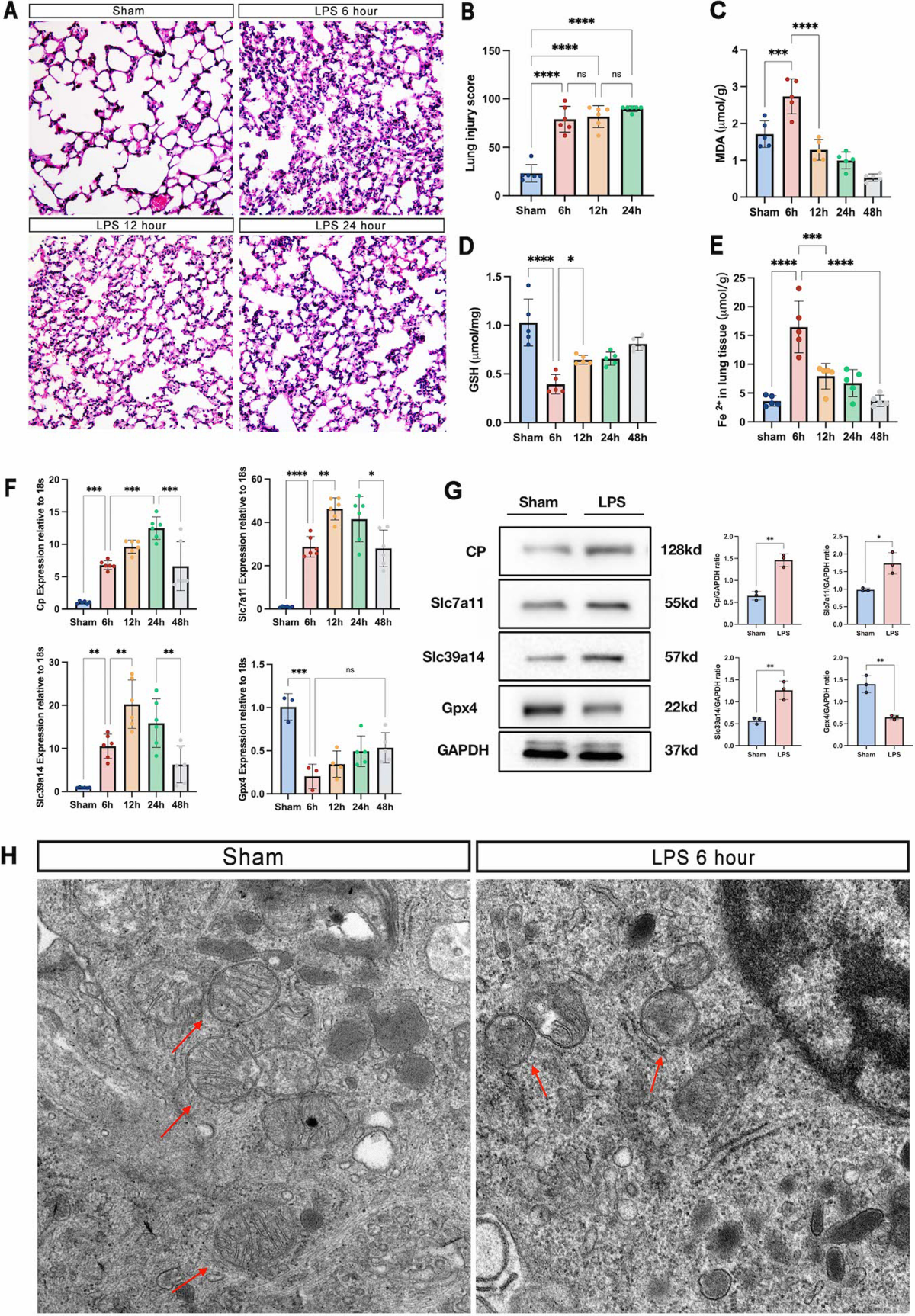 Ferroptosis-related signature and immune infiltration characterization in  acute lung injury/acute respiratory distress syndrome | Respiratory  Research | Springer Nature Link