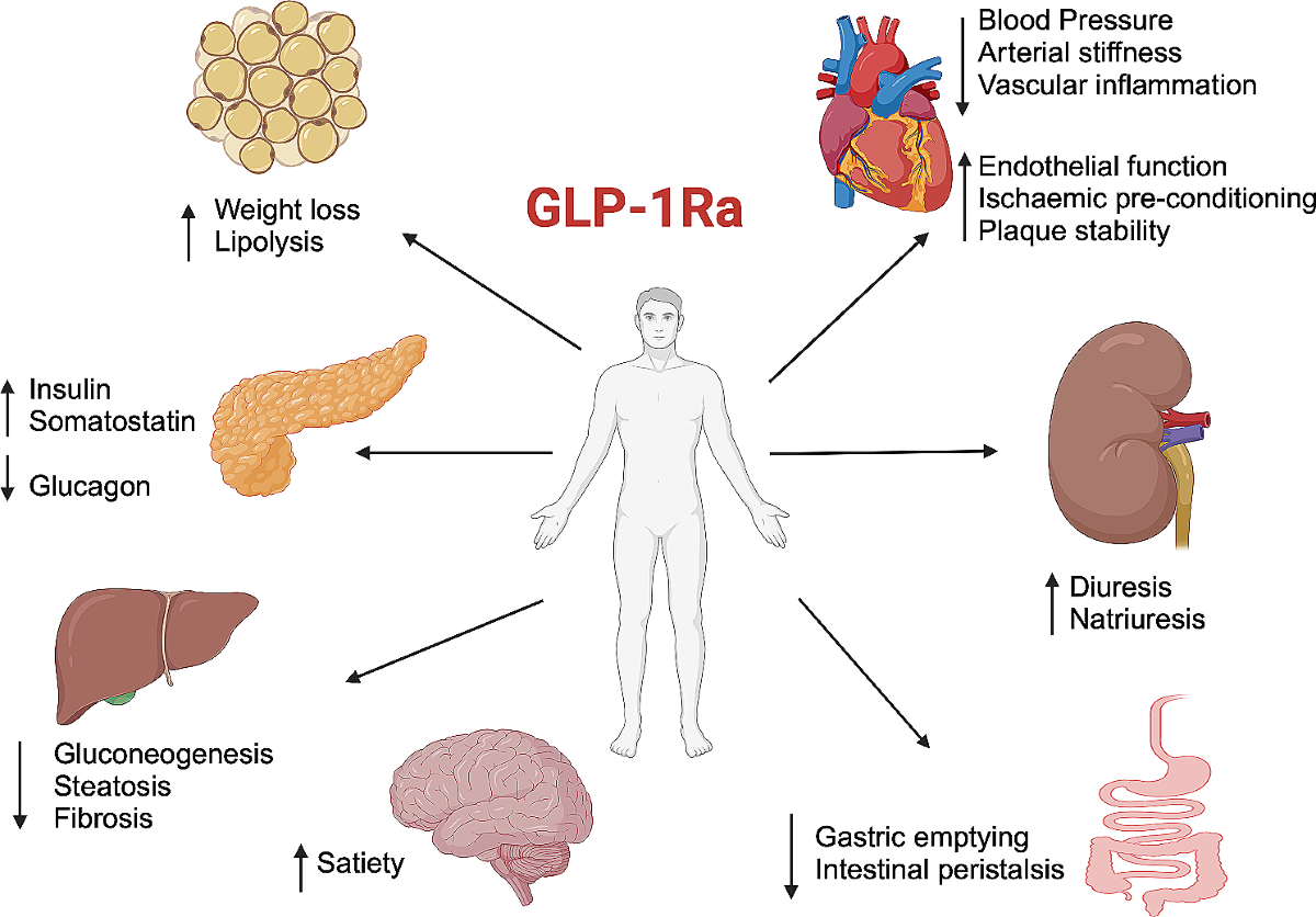 is glp-1 insulin Schematic pathway showing release of insulin by GLP-1. Binding of GLP-1...