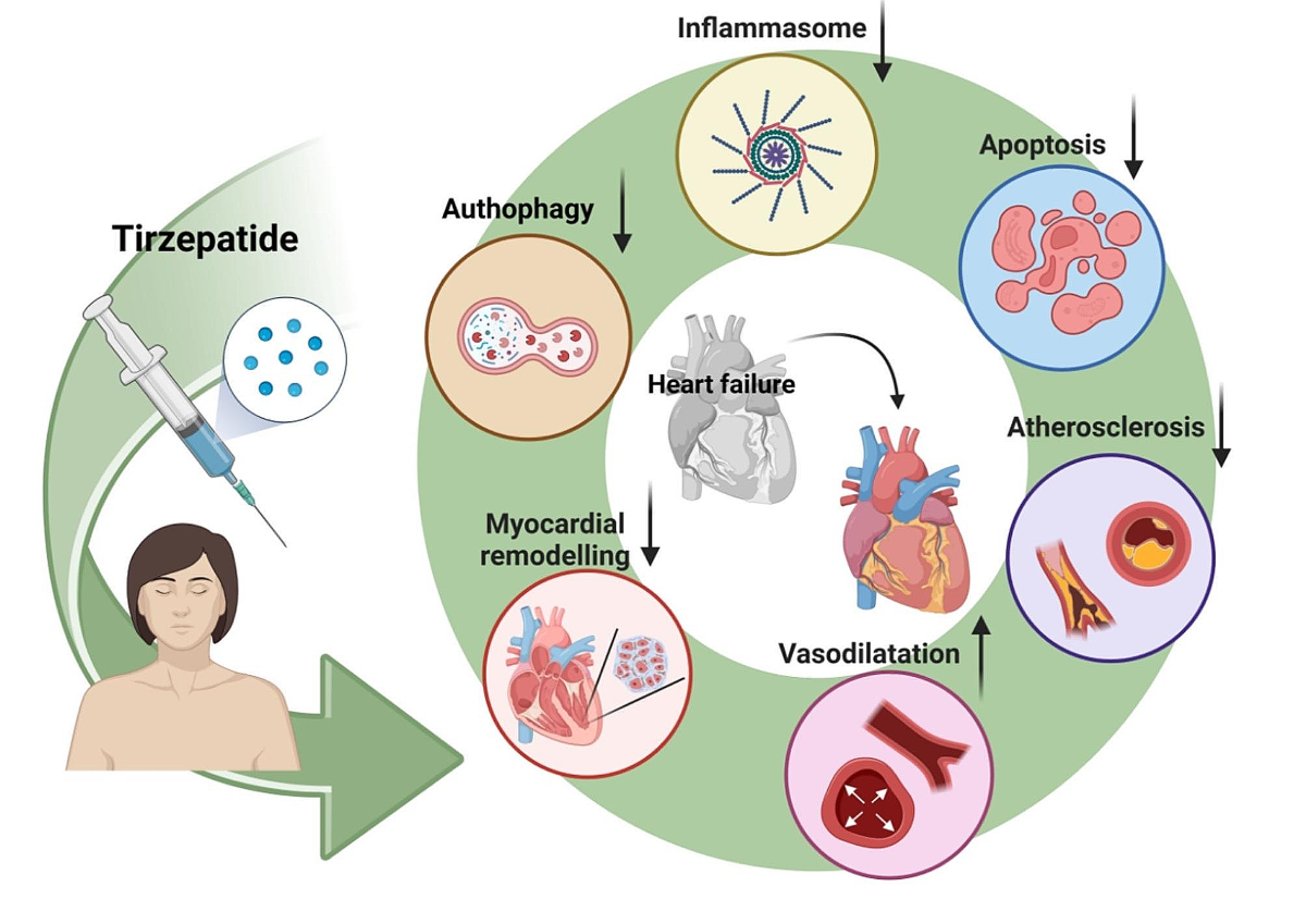 tirzepatide legal team in kentucky Bridging the gap between GLP1-receptor agonists and cardiovascular  outcomes: evidence for the role of tirzepatide | Cardiovascular Diabetology