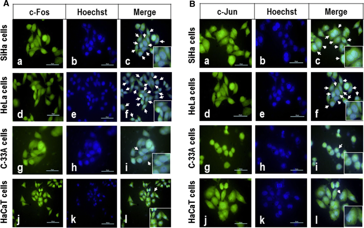 Transregulation of microRNA miR-21 promoter by AP-1 transcription factor in  cervical cancer cells | Cancer Cell International | Full Text