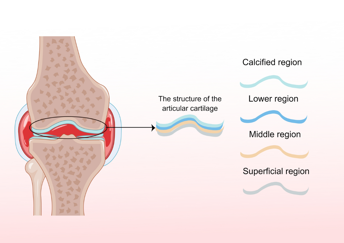 Tissue engineering strategies hold promise for the repair of articular  cartilage injury | BioMedical Engineering OnLine | Springer Nature Link