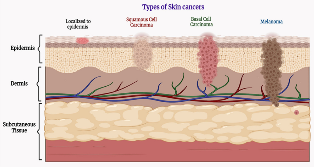 melanotan 1 vs 2 for tanning There are two peptides people talk about for tanning: Melanotan 1 and Melanotan  2. Melanotan 1 works slower and mainly targets the skin, leading to a more  gradual and even increase in
