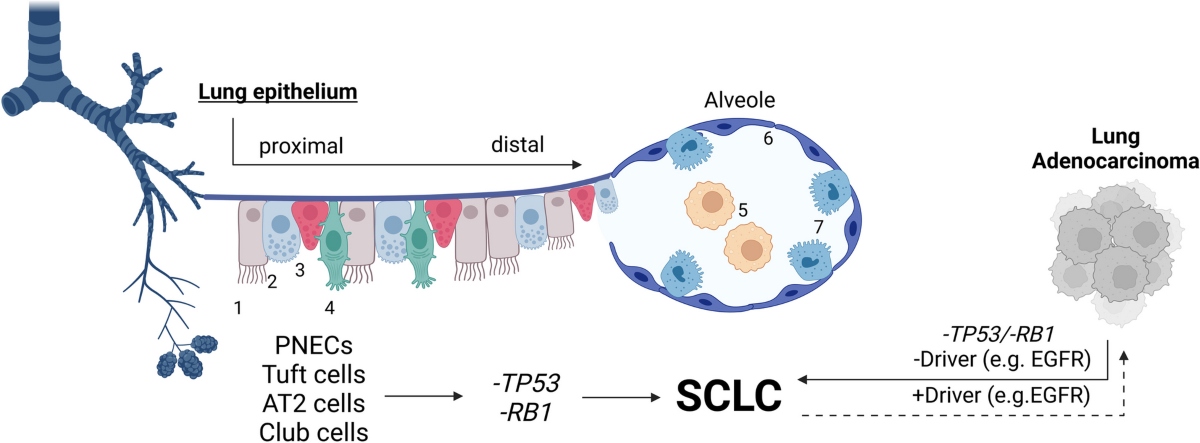 glutathione small cell lung cancer cells – big issues: biological implications and preclinical advancements in small | Molecular Cancer Discoloration