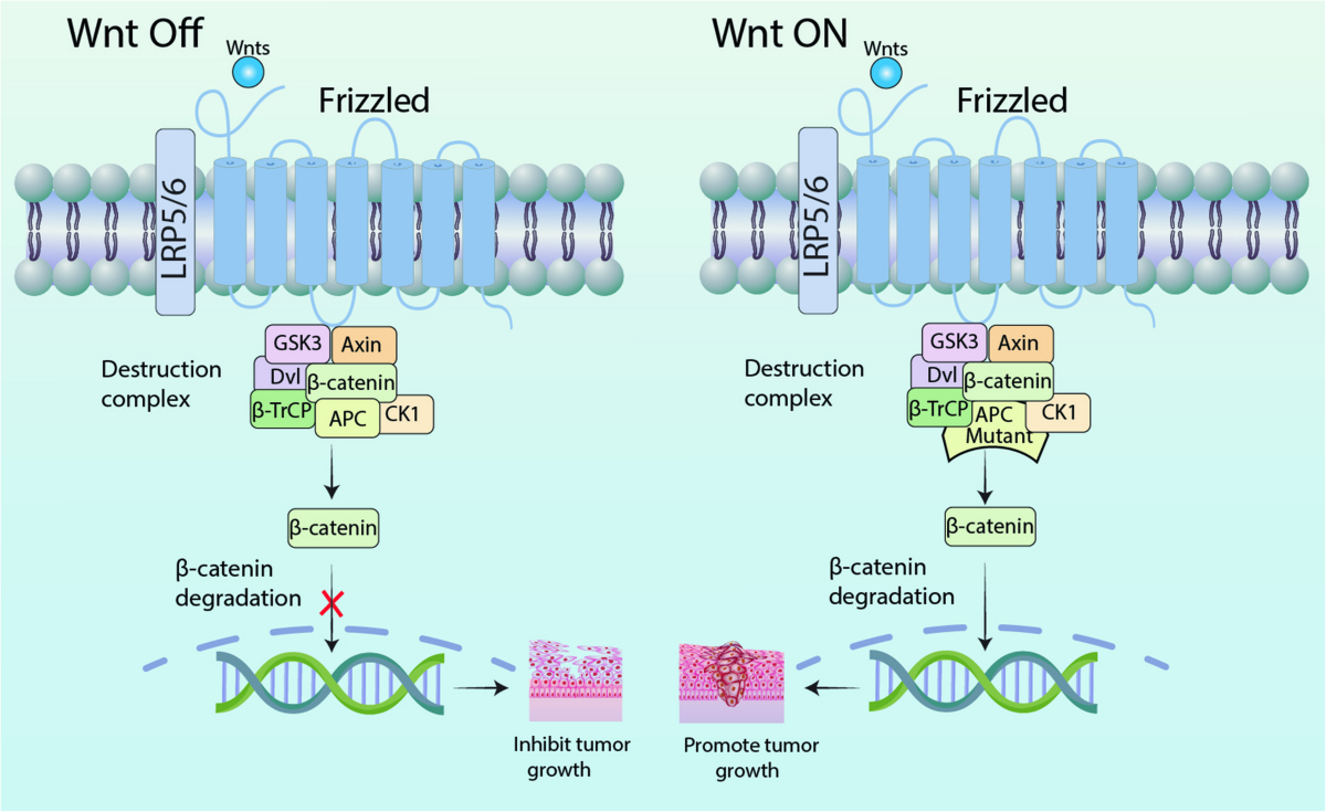 Wnt signaling in cancer: from biomarkers to targeted therapies and clinical translation | Molecular Cancer | Springer Nature Link Wnt signaling in cancer: from biomarkers to targeted therapies and clinical translation | Molecular Cancer | Springer Nature Link