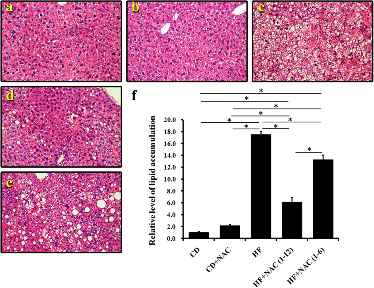 Long term N-acetylcysteine administration rescues liver steatosis via  endoplasmic reticulum stress with unfolded protein response in mice |  Lipids in Health and Disease