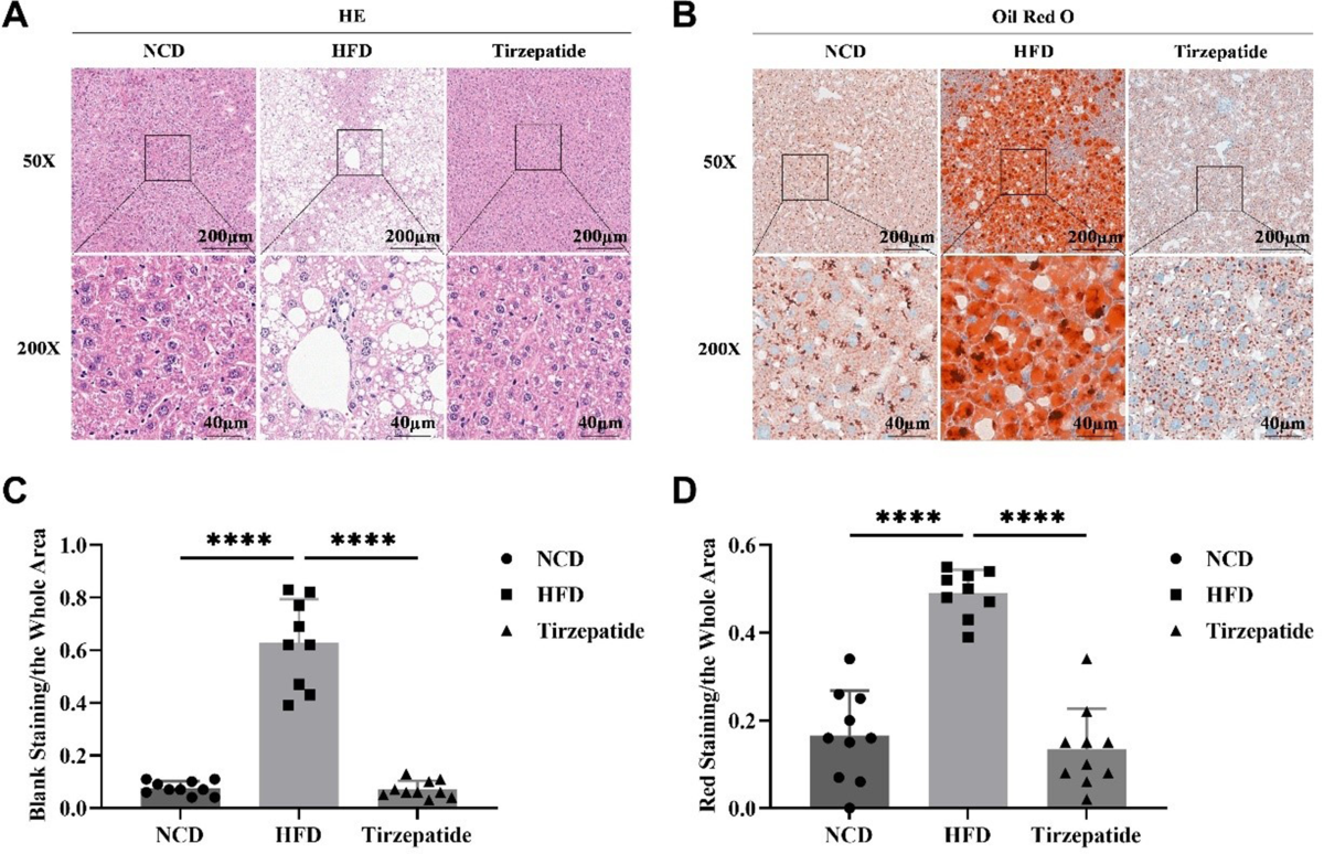 can tirzepatide increase liver enzymes Exploring the molecular mechanisms of tirzepatide in alleviating metabolic  dysfunction-associated fatty liver in mice through integration of  metabolomics, lipidomics, and proteomics | Lipids in Health and Disease
