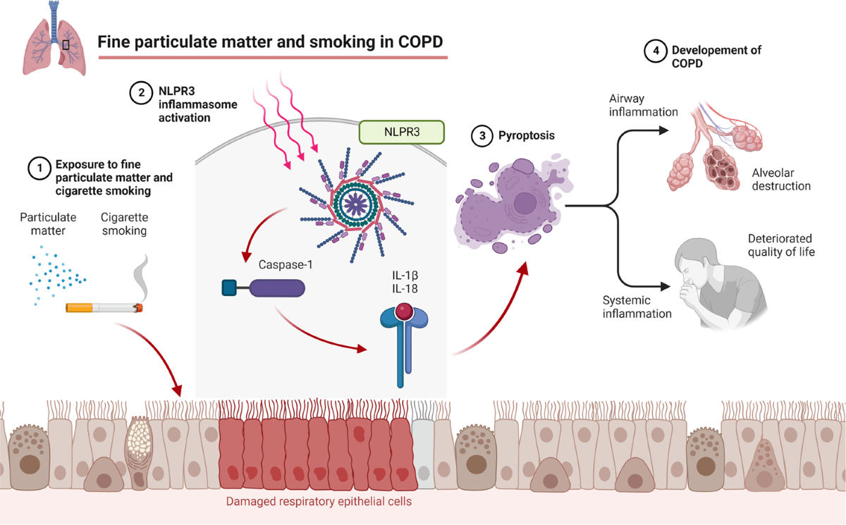 particulate matter in cigarette smoke Fine particulate matter aggravates smoking induced lung injury via  NLRP3/caspase-1 pathway in COPD | Journal of Inflammation