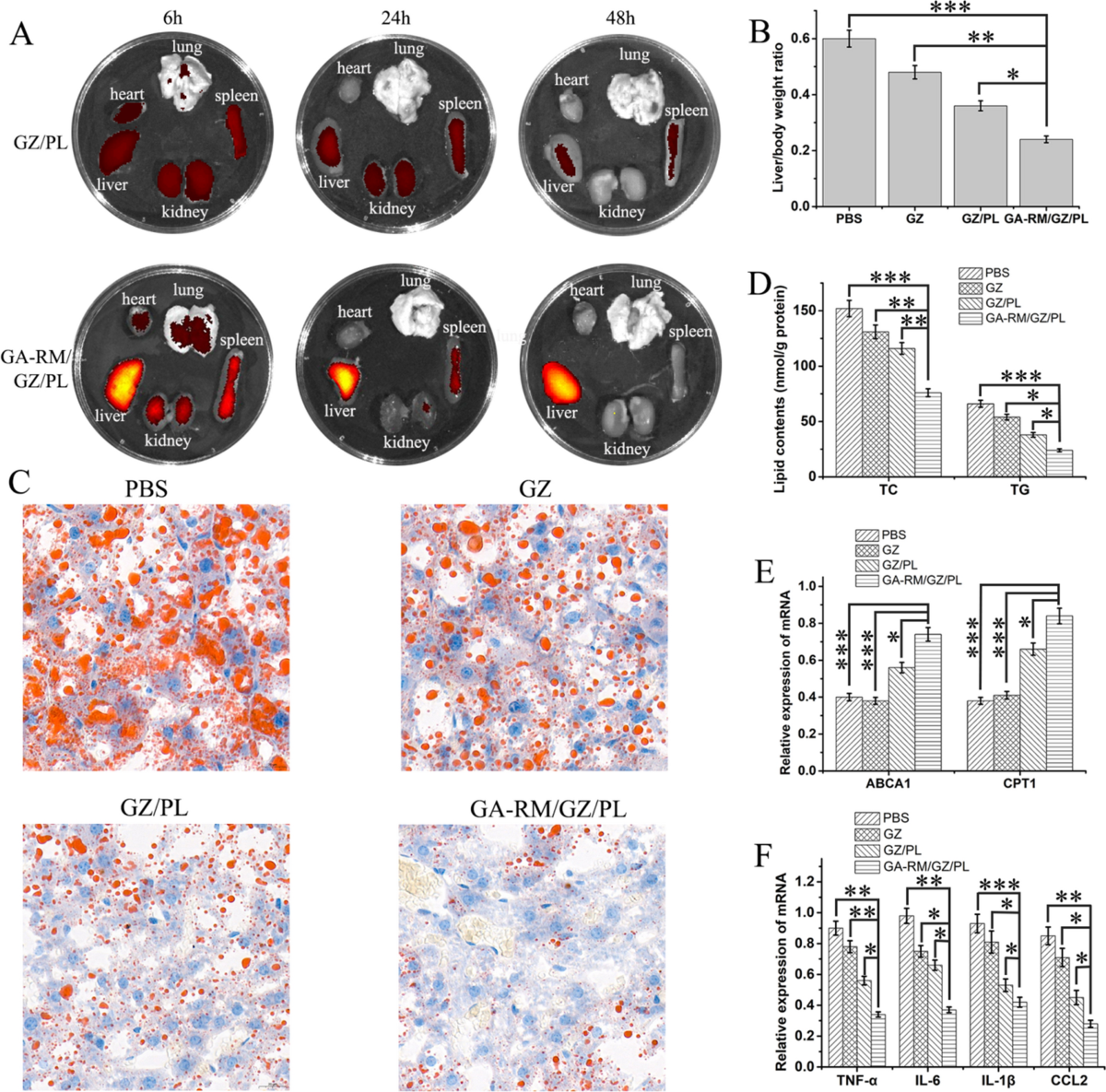 A nanodrug system overexpressed circRNA_0001805 alleviates nonalcoholic  fatty liver disease via miR-106a-5p/miR-320a and ABCA1/CPT1 axis | Journal  of Nanobiotechnology | Springer Nature Link