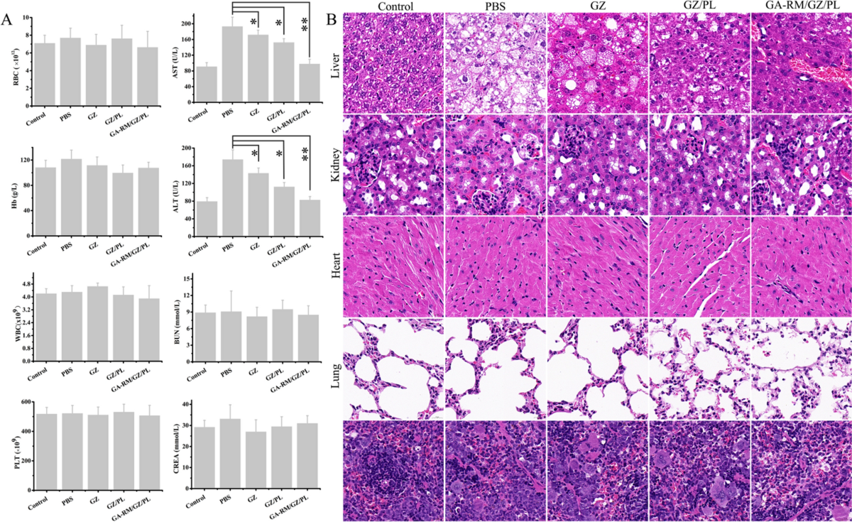 A nanodrug system overexpressed circRNA_0001805 alleviates nonalcoholic  fatty liver disease via miR-106a-5p/miR-320a and ABCA1/CPT1 axis | Journal  of Nanobiotechnology | Springer Nature Link