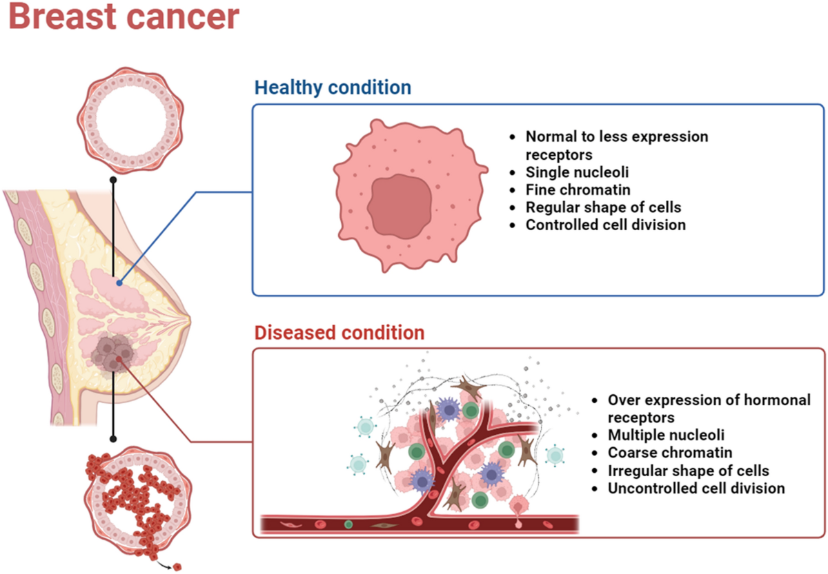 Harnessing the nutriceutics in early-stage breast cancer: mechanisms, combinational therapy, and drug delivery | Journal of Nanobiotechnology | Full Text harnessing-the-nutriceutics-in-early-stage-breast-cancer-mechanisms-combinational-therapy-and-drug-delivery-journal-of-nanobiotechnology-full-text