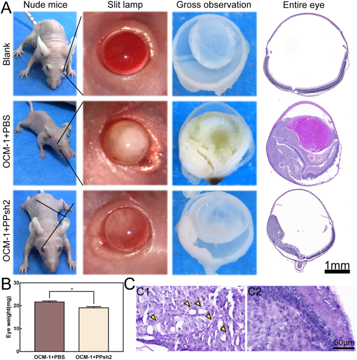 12chan.org:8081 naked b PDGFR-α shRNA-polyplex for uveal melanoma treatment via EMT mediated  vasculogenic mimicry interfering | Journal of Nanobiotechnology | Full Text