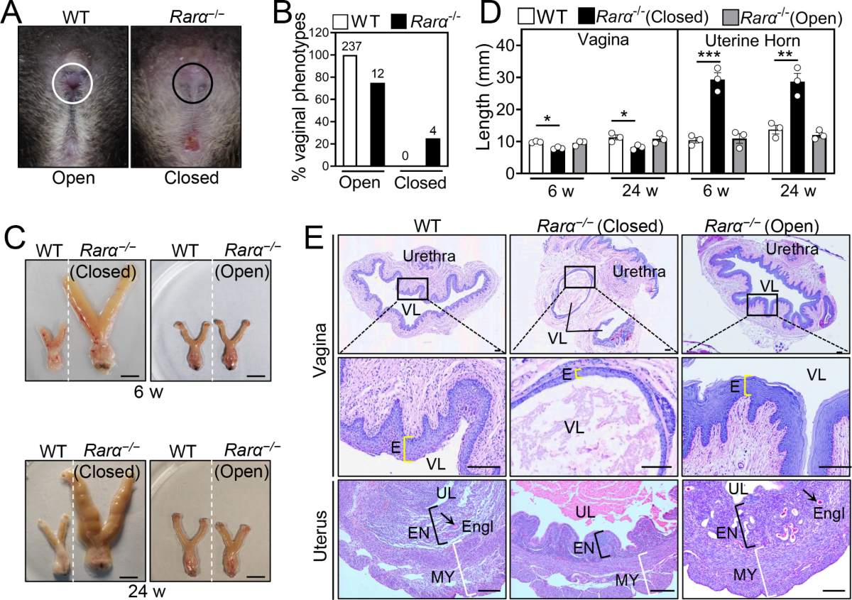 tween open vagina RA-RAR signaling promotes mouse vaginal opening through increasing  β-catenin expression and vaginal epithelial cell apoptosis | Reproductive  Biology and Endocrinology | Full Text