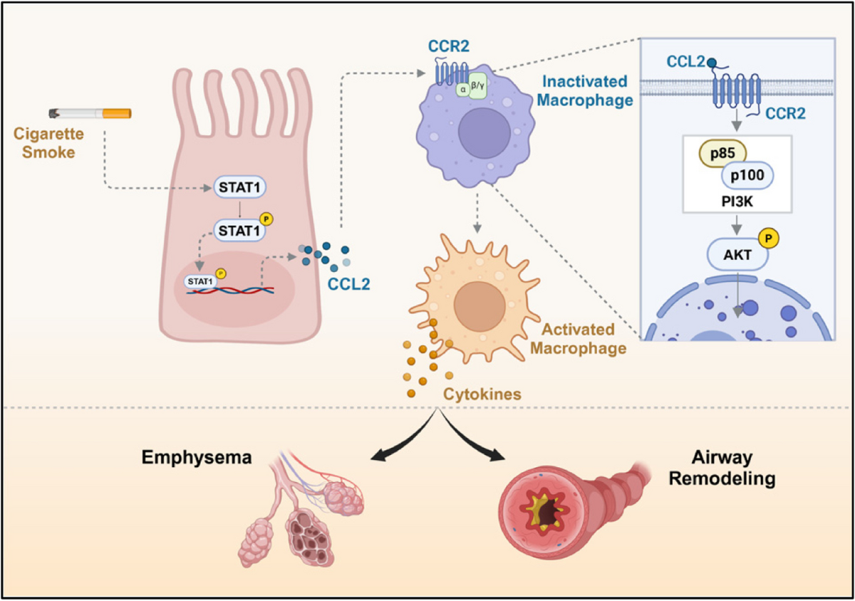 Targeting CCL2-CCR2 signaling pathway alleviates macrophage 