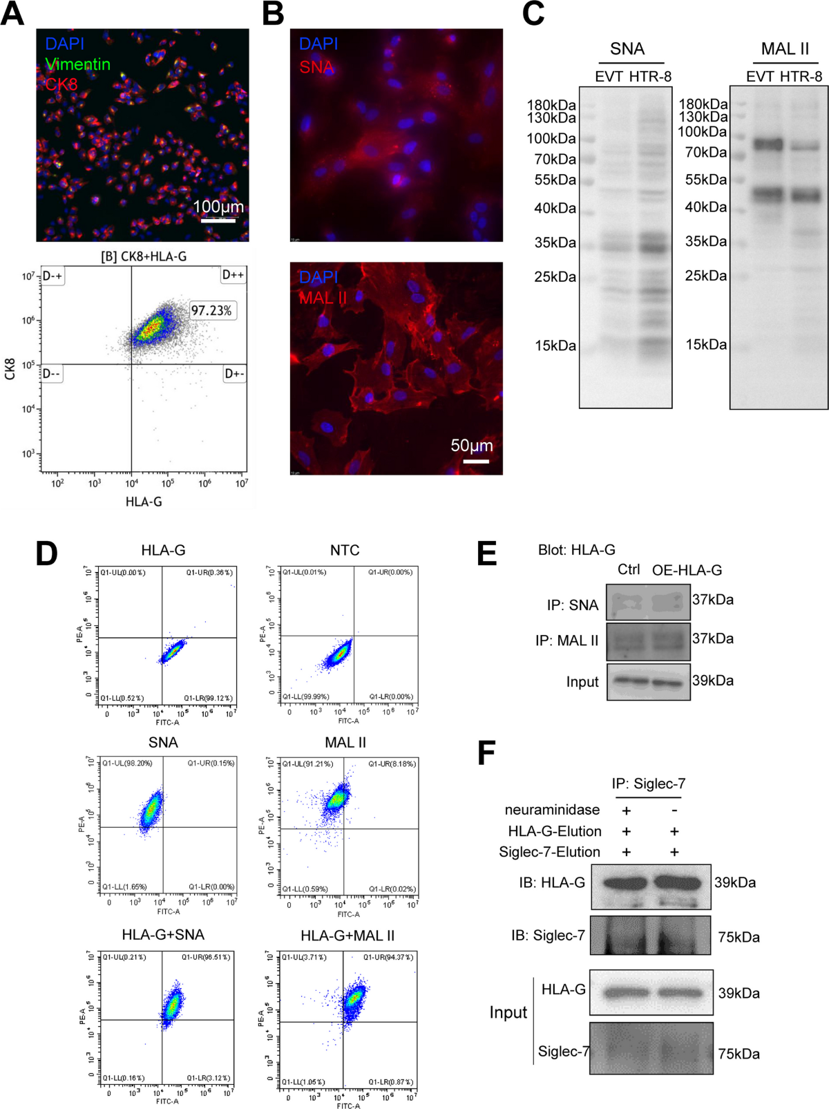 Defective HLA-G1 glycosylation disrupts Siglec-7–mediated NK cell tolerance at the maternal–fetal interface in recurrent pregnancy loss | Cell Communication and Signaling