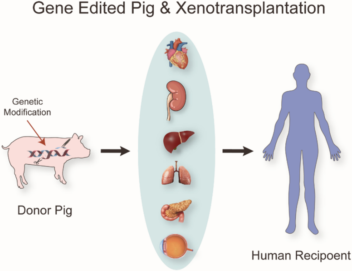 Complement networks in gene-edited pig xenotransplantation: enhancing  transplant success and addressing organ shortage | Journal of Translational  Medicine | Full Text