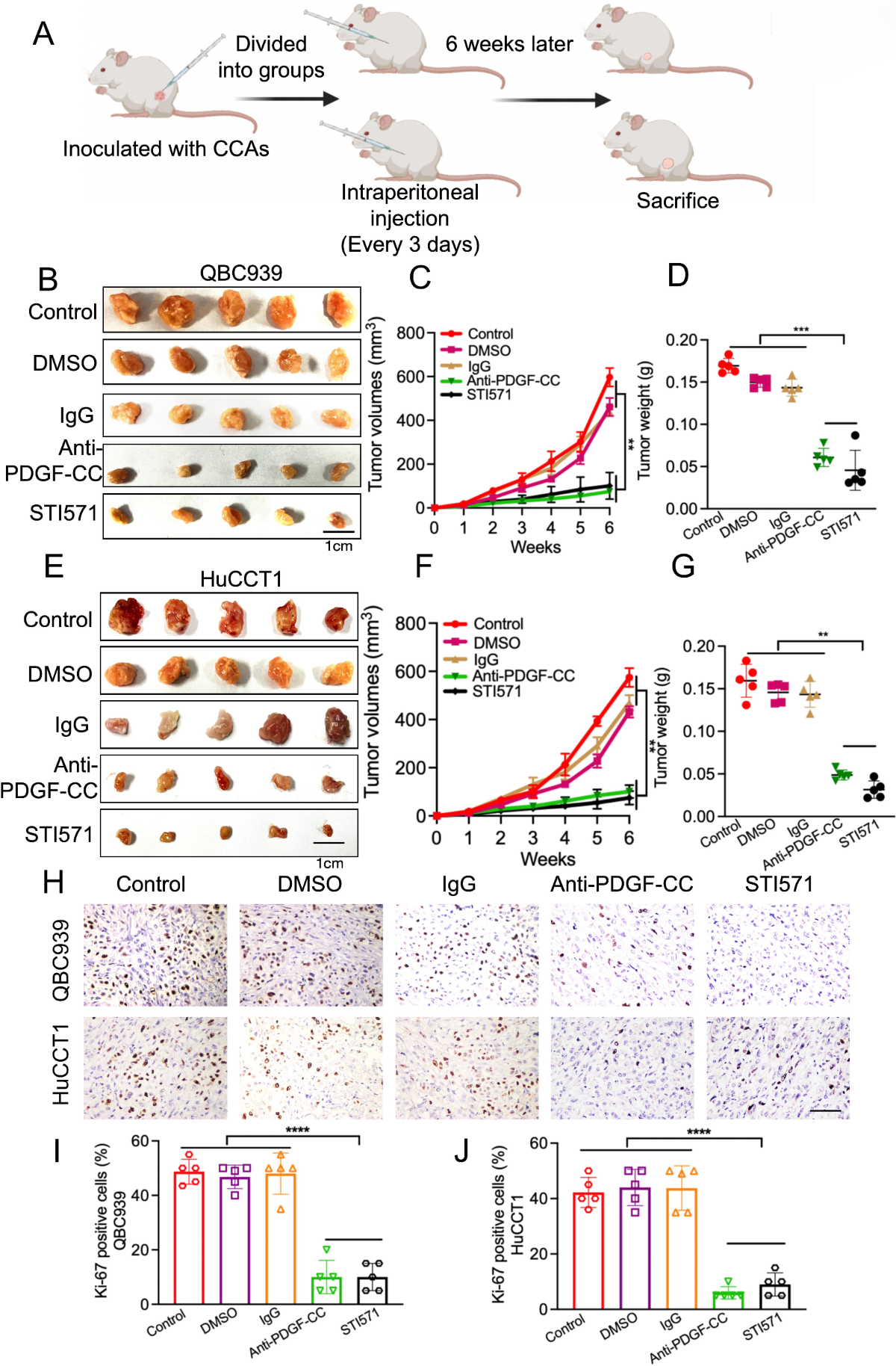 Targeting PDGF-CC as a promising therapeutic strategy to inhibit  cholangiocarcinoma progression | Journal of Translational Medicine