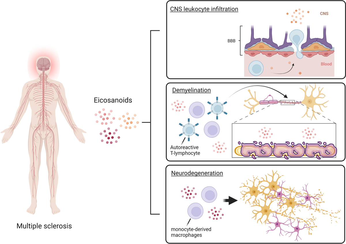 l glutathione and multiple sclerosis Arachidonic acid-derived lipid mediators in multiple sclerosis  pathogenesis: fueling or dampening disease progression? | Journal of  Neuroinflammation