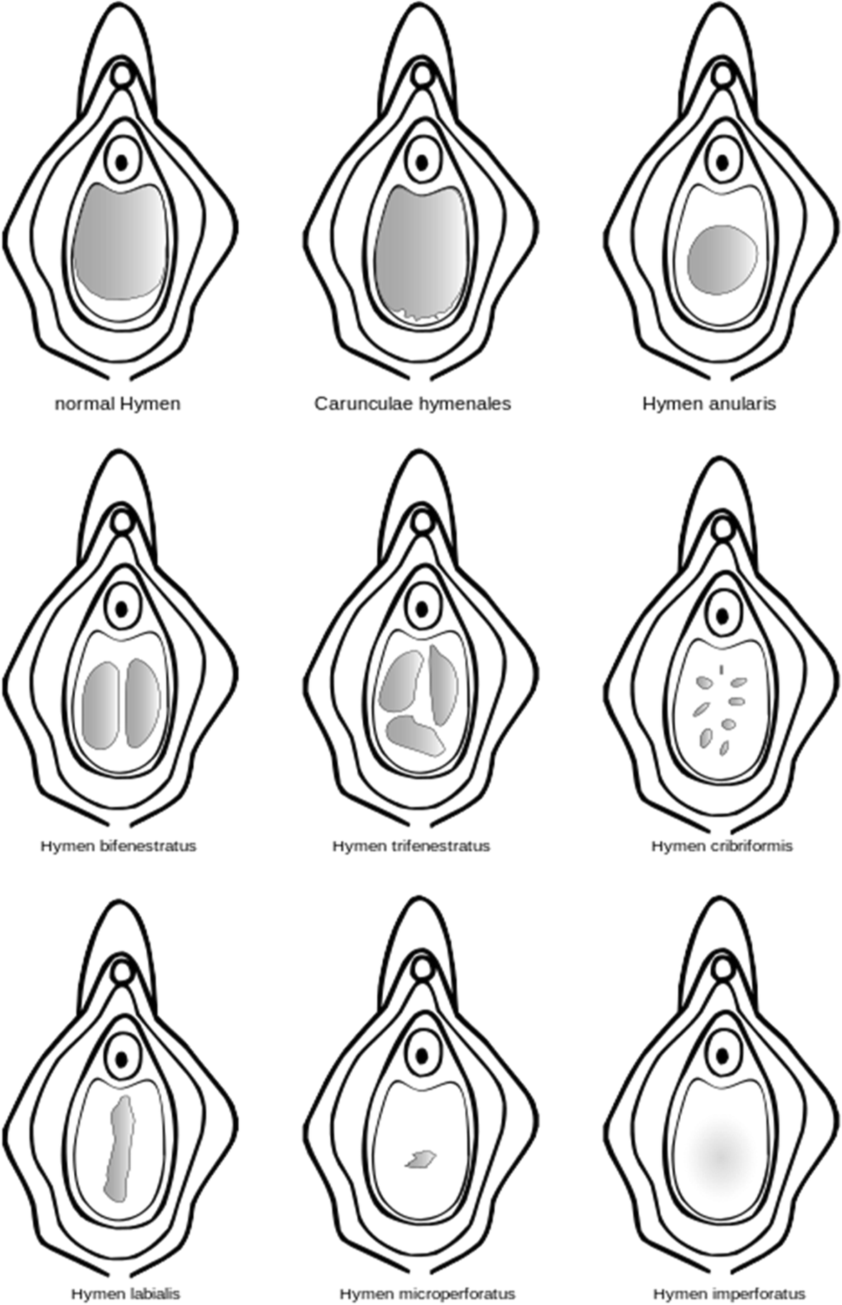 girls showing hymen 