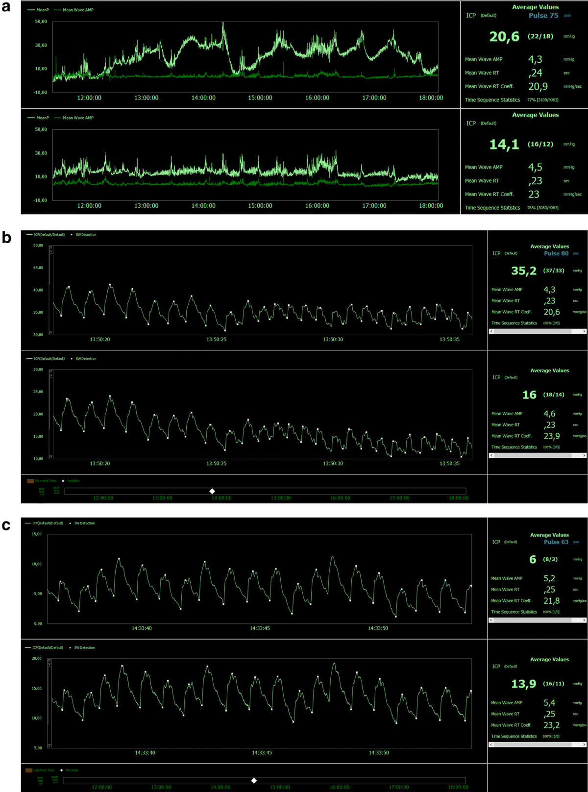 Measuring intracranial pressure by invasive, less invasive or non-invasive  means: limitations and avenues for improvement | Fluids and Barriers of the  CNS | Springer Nature Link