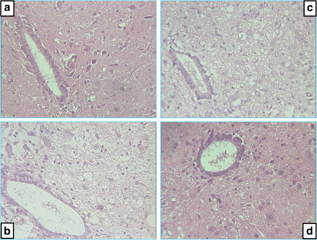 Stable gastric pentadecapeptide BPC 157 can improve the healing course of spinal  cord injury and lead to functional recovery in rats | Journal of  Orthopaedic Surgery and Research