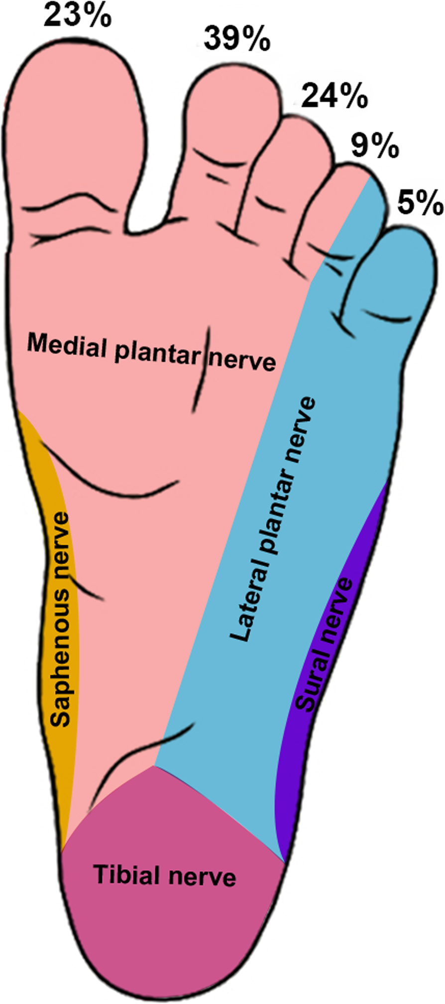 Clinical characteristics of 93 cases of isolated macrodactyly of the foot  in children | Journal of Orthopaedic Surgery and Research | Full Text