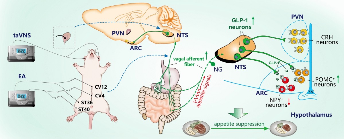 glp 1 vagus nerve Acupuncture ameliorates diet-induced obesity via the vagal–GLP-1–ARC  circuit: neural mechanism of anorexigenic action | Chinese Medicine