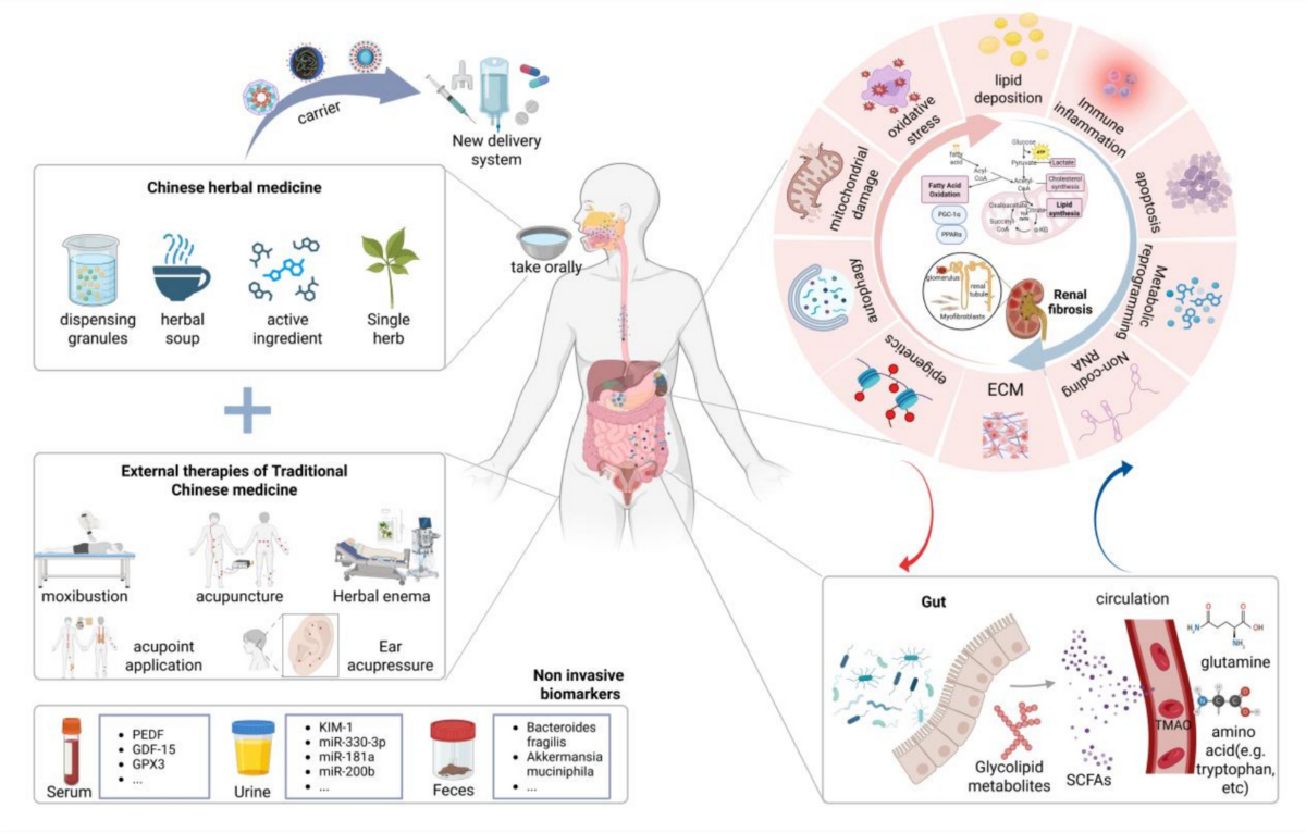 Fatty acid metabolism: opportunities and challenges of traditional Chinese  medicine in the treatment of renal fibrosis | Chinese Medicine | Springer  Nature Link