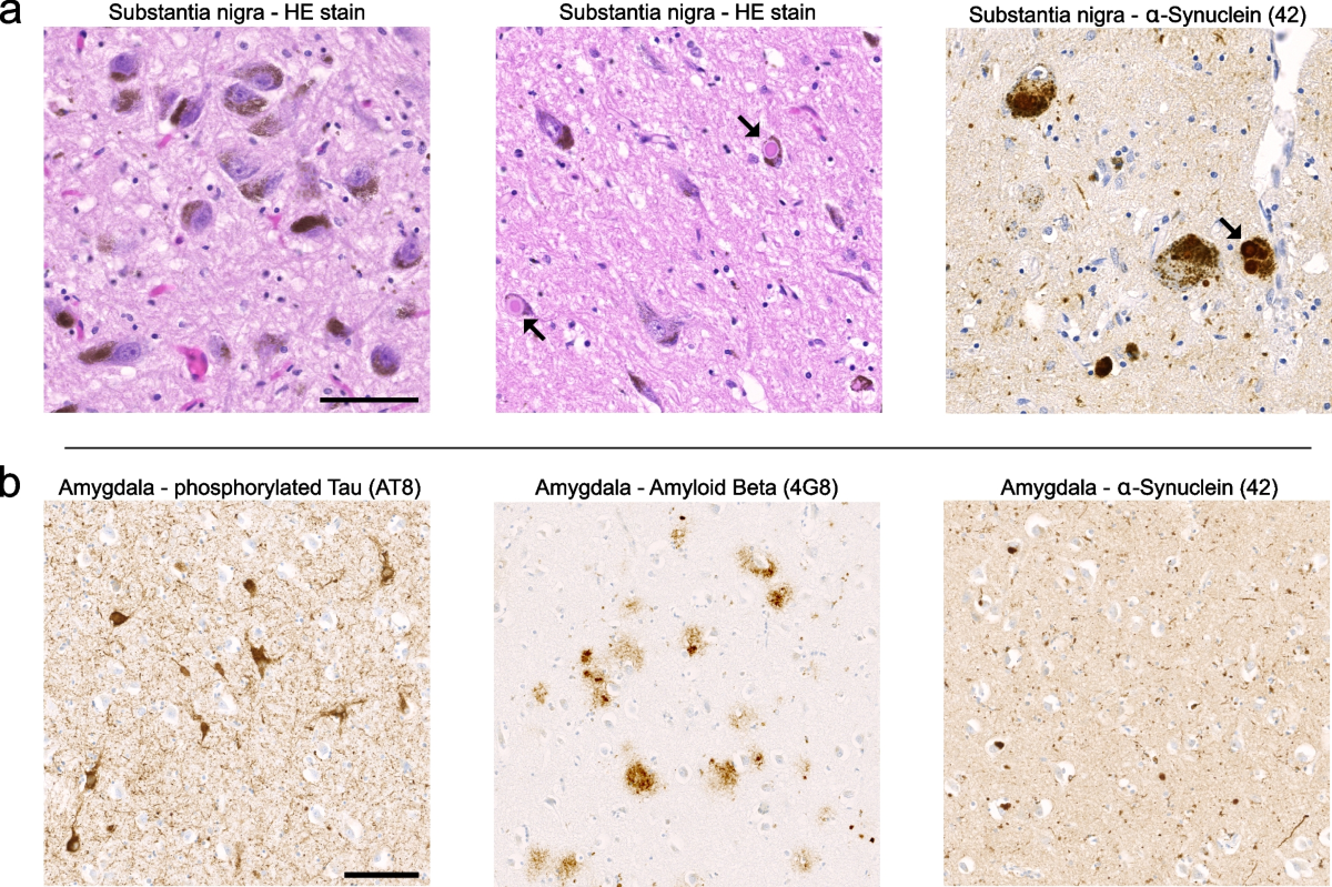 glutathion et parkinson Frontiers Glutathione Homeostasis and Functions: Potential