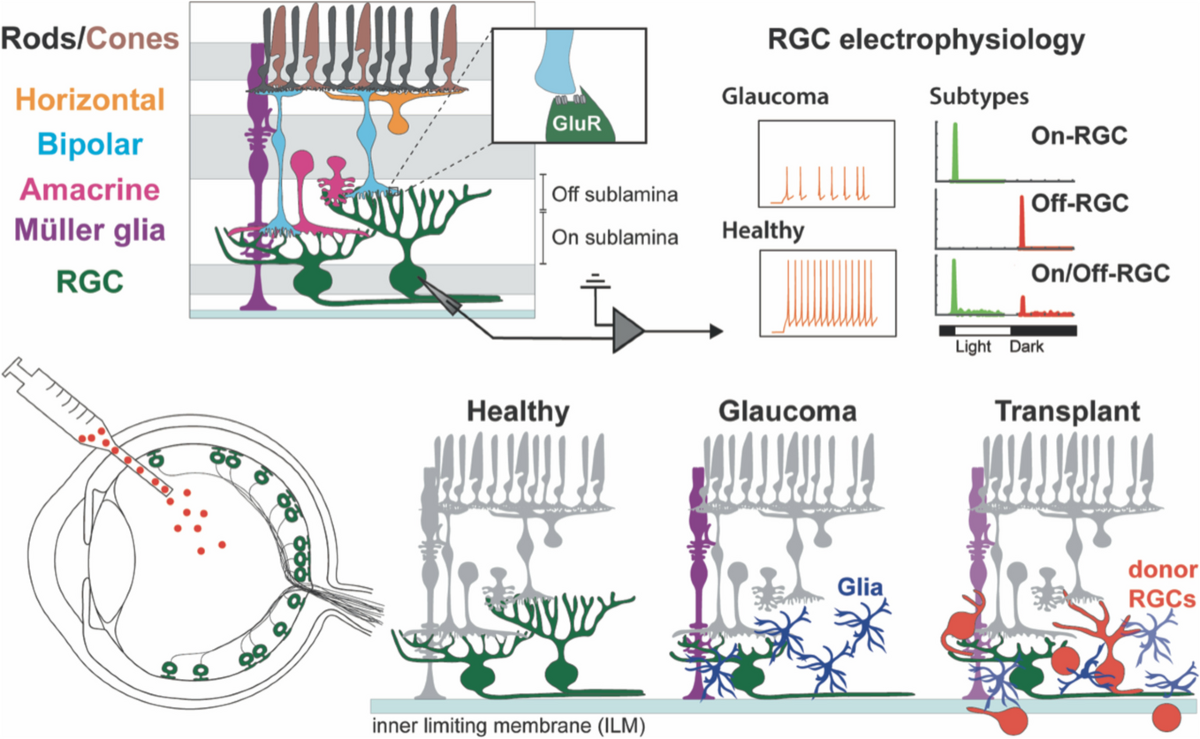 Retinal ganglion cell repopulation for vision restoration in optic  neuropathy: a roadmap from the RReSTORe Consortium, Molecular  Neurodegeneration