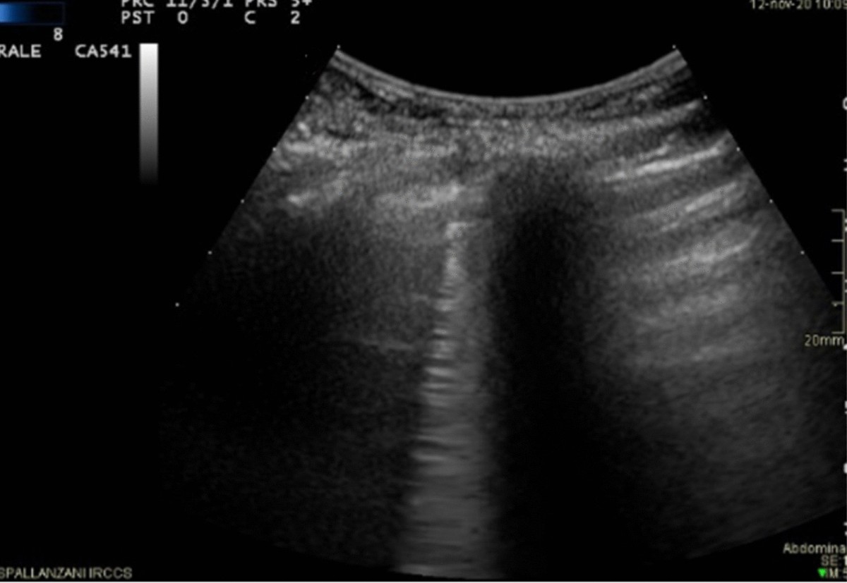 Frontiers | Coordinated innate and T-cell immune responses in mild COVID-19  patients from household contacts of COVID-19 cases during the first  pandemic wave, image size:1200x827