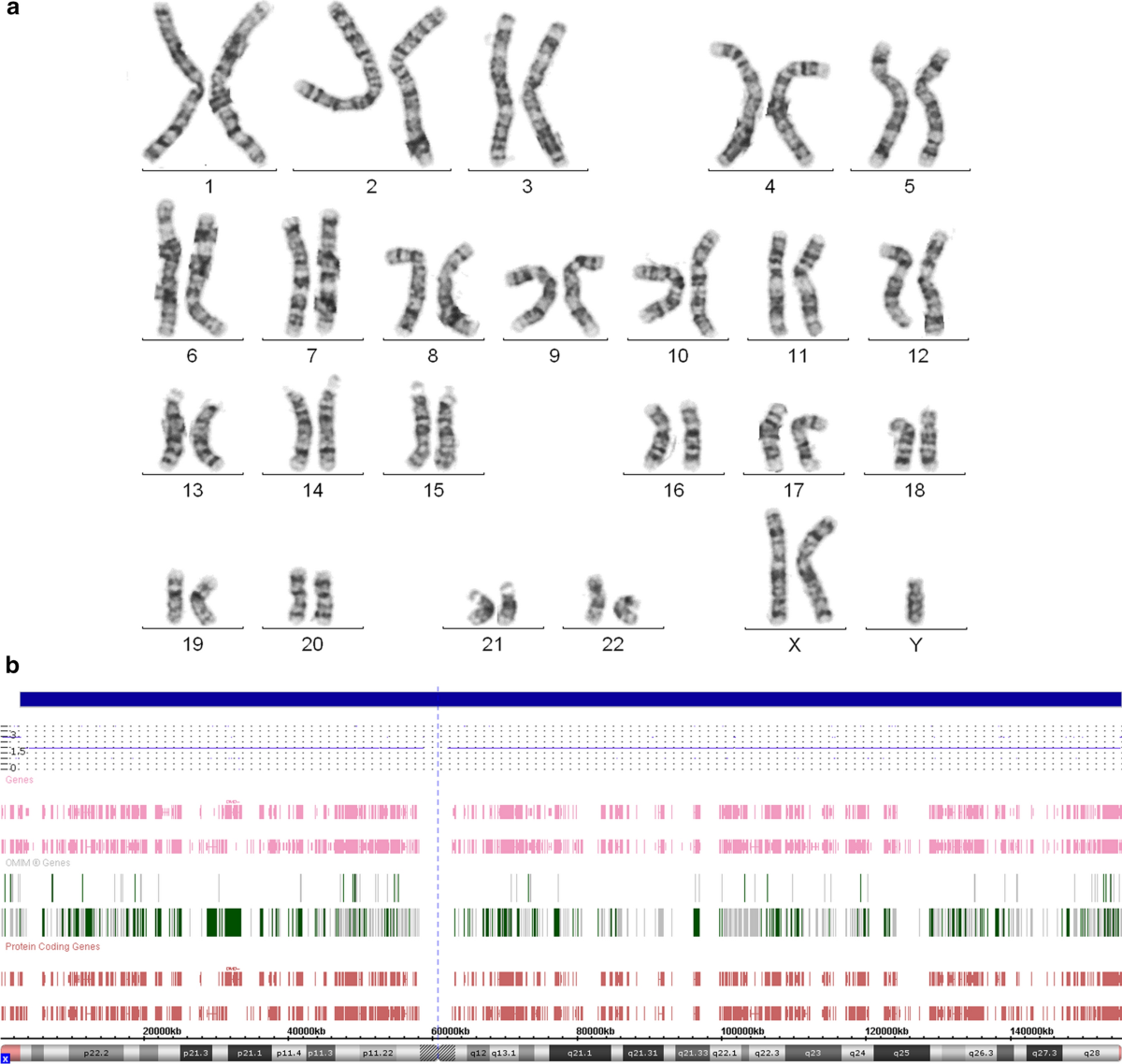 Klinefelter syndrome mosaicism in boys with neurodevelopmental disorders: a  cohort study and an extension of the hypothesis | Molecular Cytogenetics, image size:1200x1138
