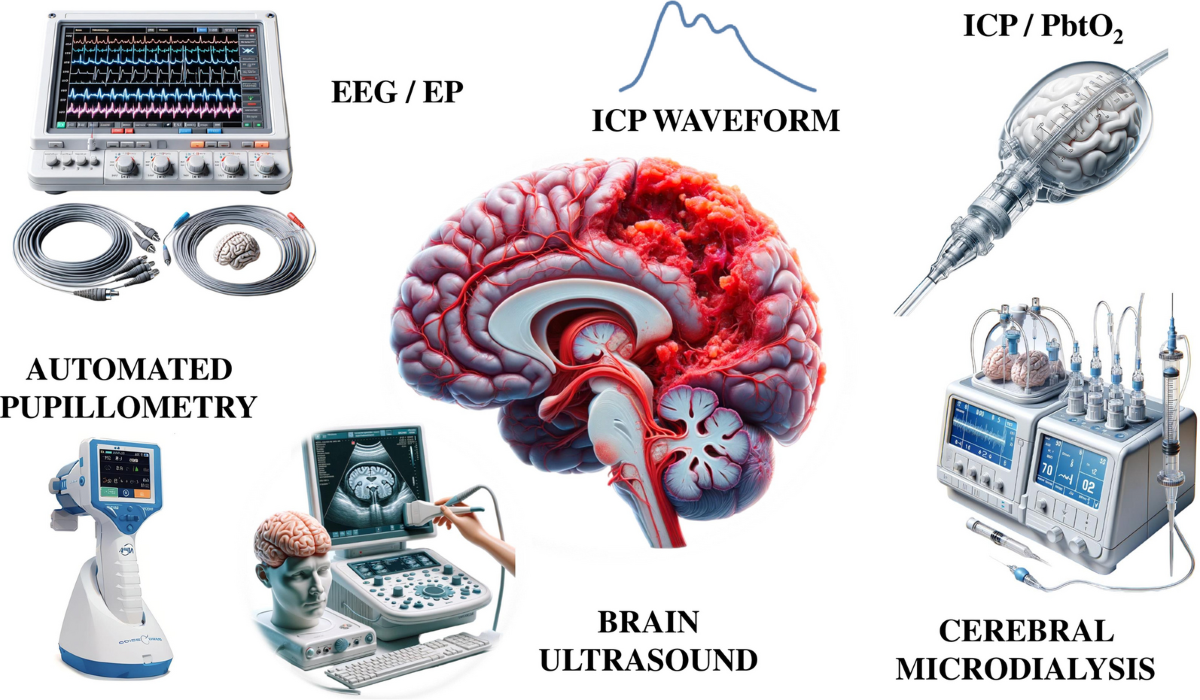 NeuroVanguard”: a contemporary strategy in neuromonitoring for severe adult  brain injury patients | Critical Care | Springer Nature Link