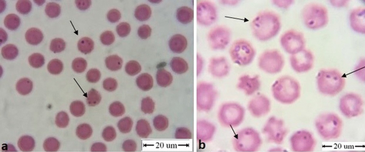 Epidemiology and genotyping of Anaplasma marginale and co-infection with piroplasms and other Anaplasmataceae in cattle and buffaloes from Egypt | Parasites & Vectors | Full Text