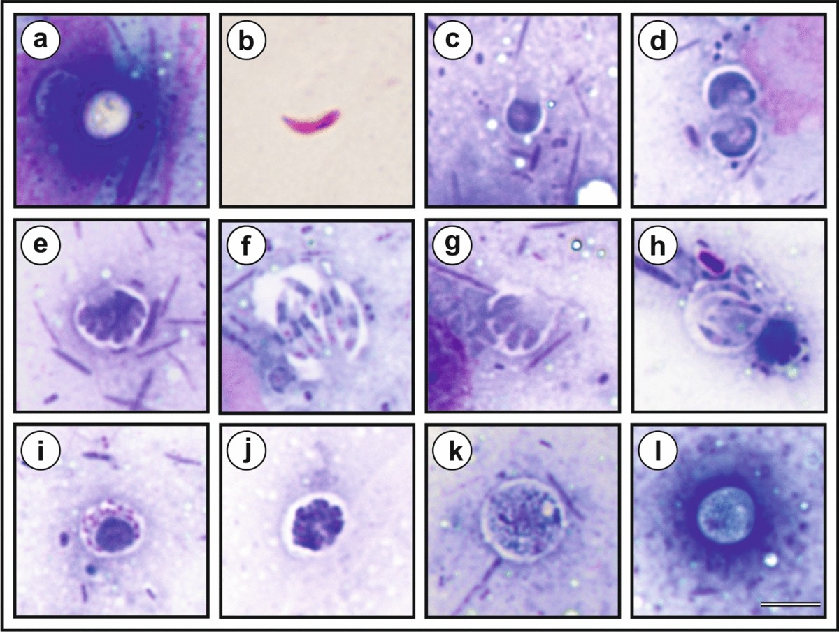 Cryptosporidium mortiferum n. sp. (Apicomplexa: Cryptosporidiidae), the  species causing lethal cryptosporidiosis in Eurasian red squirrels (Sciurus  vulgaris) | Parasites & Vectors | Springer Nature Link