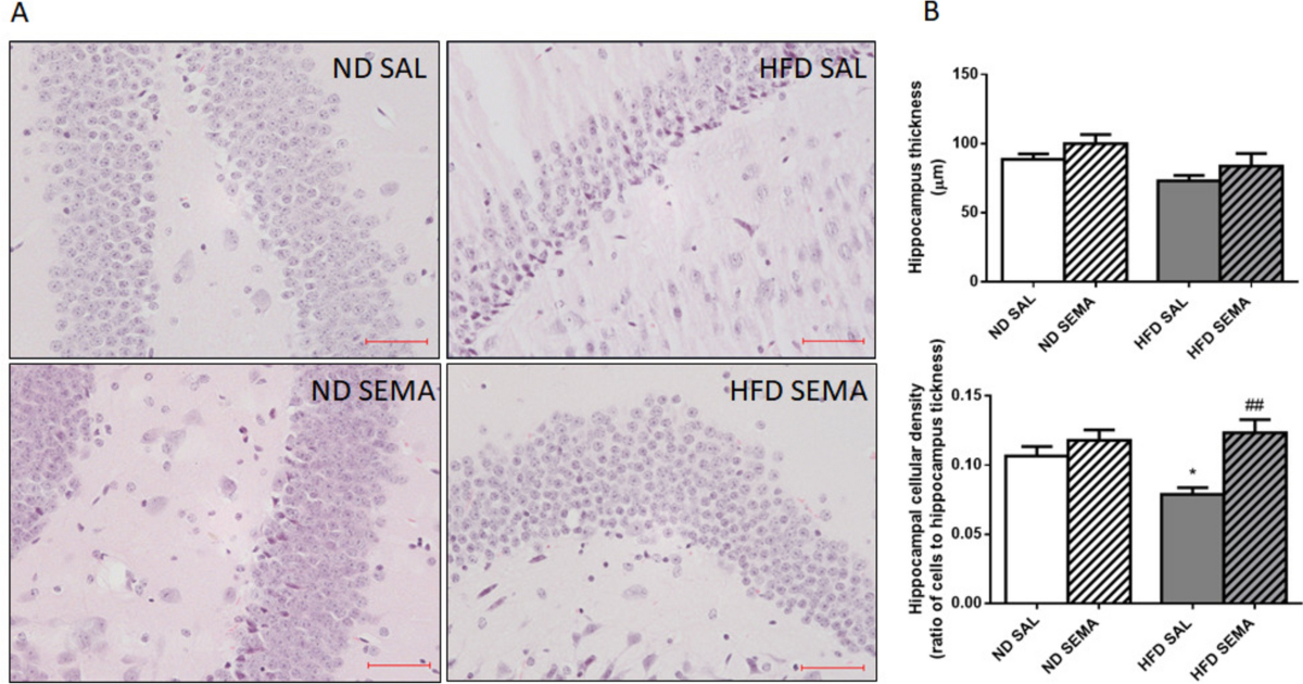 semaglutide blood brain barrier Semaglutide restores astrocyte–vascular interactions and blood–brain barrier  integrity in a model of diet-induced metabolic syndrome | Diabetology &  Metabolic Syndrome