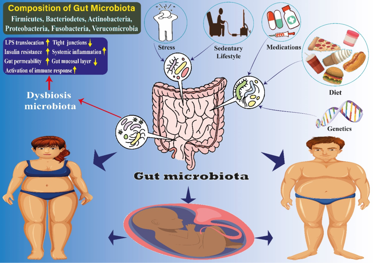 Understanding the complex function of gut microbiota: its impact on the  pathogenesis of obesity and beyond: a comprehensive review | Diabetology \u0026  Metabolic Syndrome, image size:1200x848