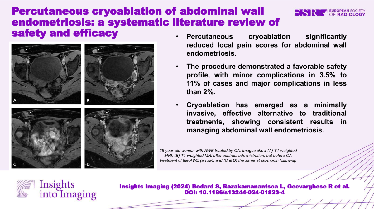 Percutaneous cryoablation of abdominal wall endometriosis: a systematic  literature review of safety and efficacy | Insights into Imaging