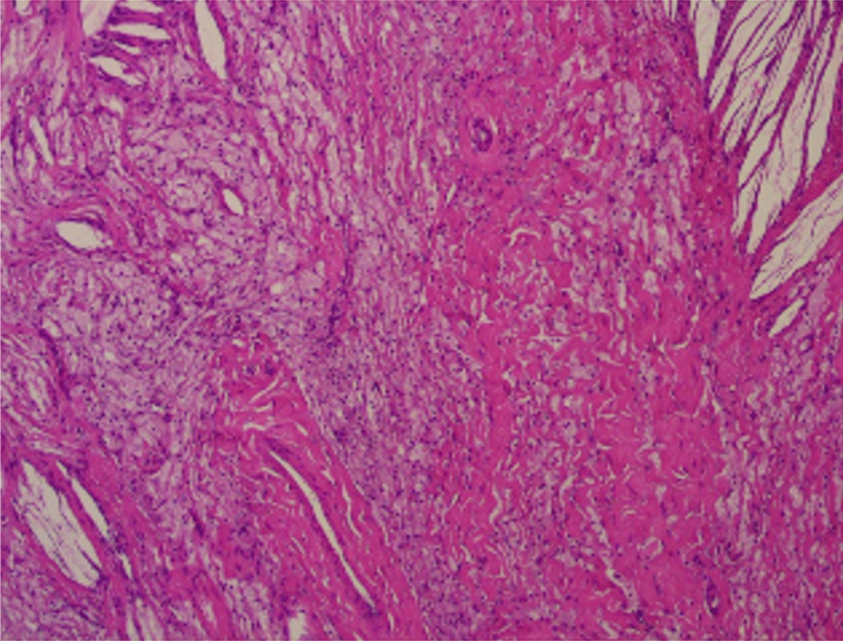 Bilateral temporal skull xanthoma characterized as a Langerhans cell  histiocytosis: a case report | Journal of Medical Case Reports, image size:1200x912