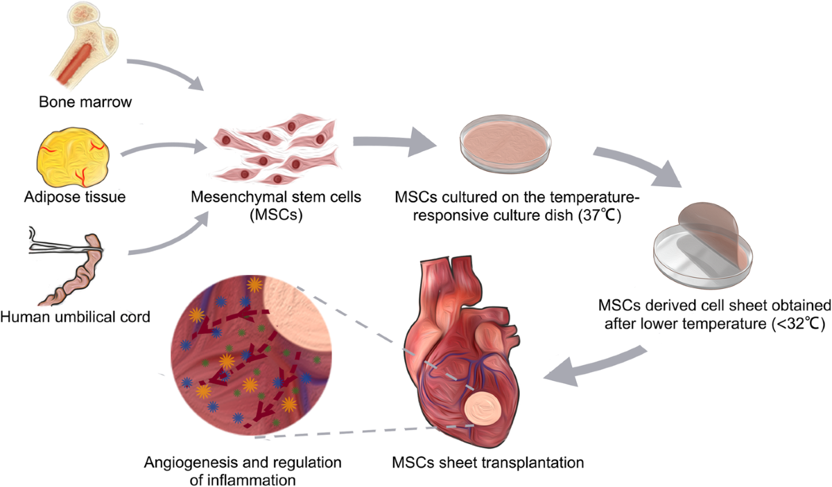 All about 
how stem cells help with 
Arrhythmias thumbnail