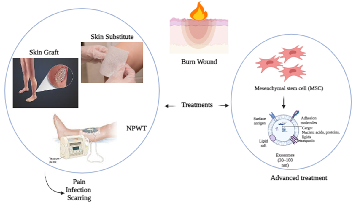 Exosomes in nanomedicine: a promising cell-free therapeutic 