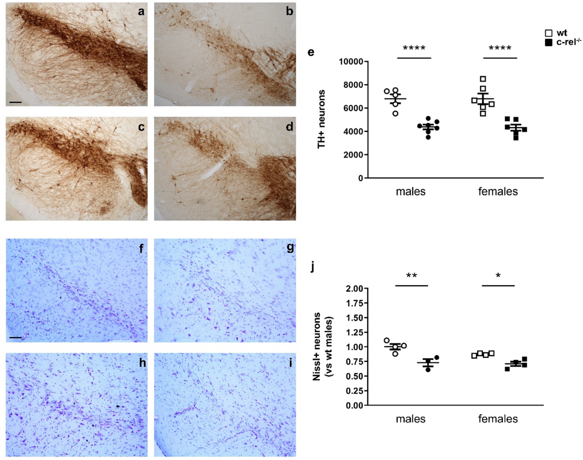 Synapsin III deficiency hampers α-synuclein aggregation, striatal synaptic  damage and nigral cell loss in an AAV-based mouse model of Parkinson's  disease | Acta Neuropathologica, image size:1200x947