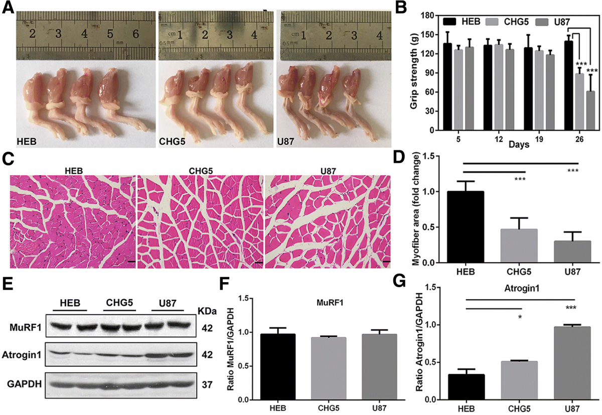 Extracellular Vesicles From Adipose Stem Cells Prevent Muscle Damage and  Inflammation in a Mouse Model of Hind Limb Ischemia | Arteriosclerosis,  Thrombosis, and Vascular Biology, image size:1200x828