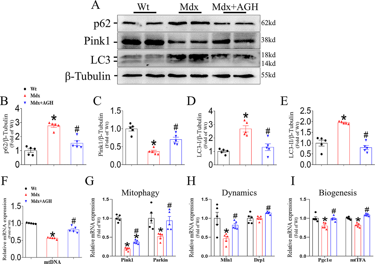 Aminoguanidine hemisulfate improves mitochondrial autophagy, oxidative stress, and muscle force in Duchenne muscular dystrophy via the AKT/FOXO1 pathway in mdx mice | Skeletal Muscle