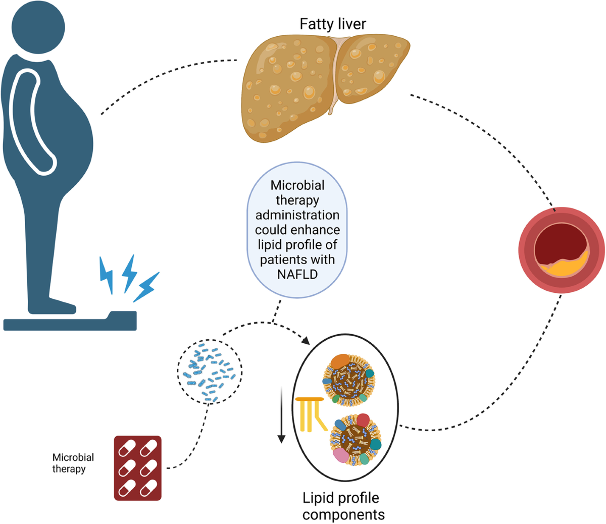 liposomal glutathione nafld or liver disease study Effects of gut microbial therapy on lipid profile in individuals with non-alcoholic fatty disease: an umbrella meta-analysis | Systematic Reviews Bundles:Sleep+Lip Serum+Soap Best IV Therapy in Generic