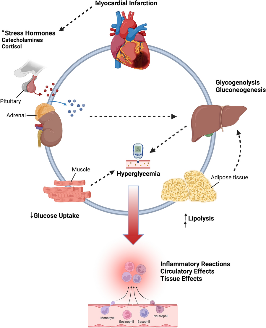 Clinical outcomes of myocardial infarction with non obstructive ...