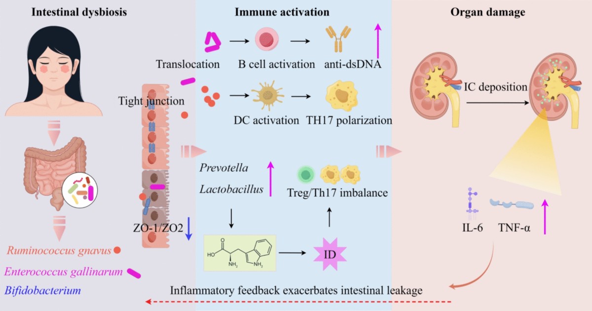 is glutathione safe for lupus Gut microbiota and metabolism in systemic lupus erythematosus: from  dysbiosis to targeted interventions | European Journal of Medical Research