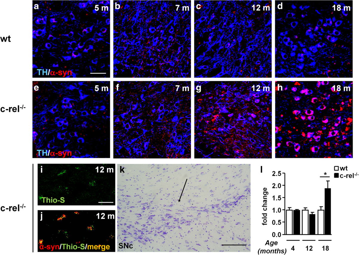 NF-κB/c-Rel deficiency causes Parkinson's disease-like prodromal symptoms  and progressive pathology in mice | Translational Neurodegeneration, image size:1200x854