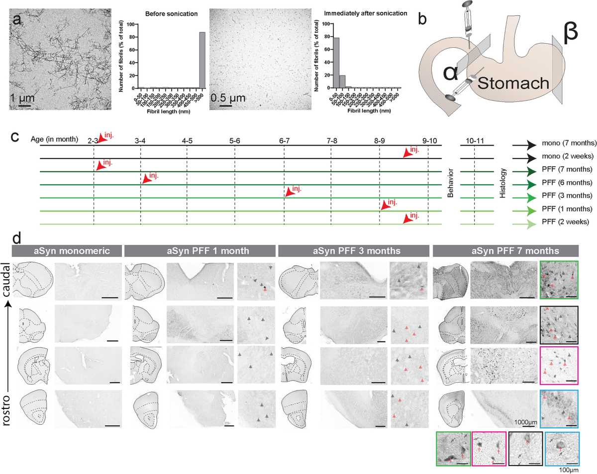 Gut-initiated alpha synuclein fibrils drive parkinsonism 