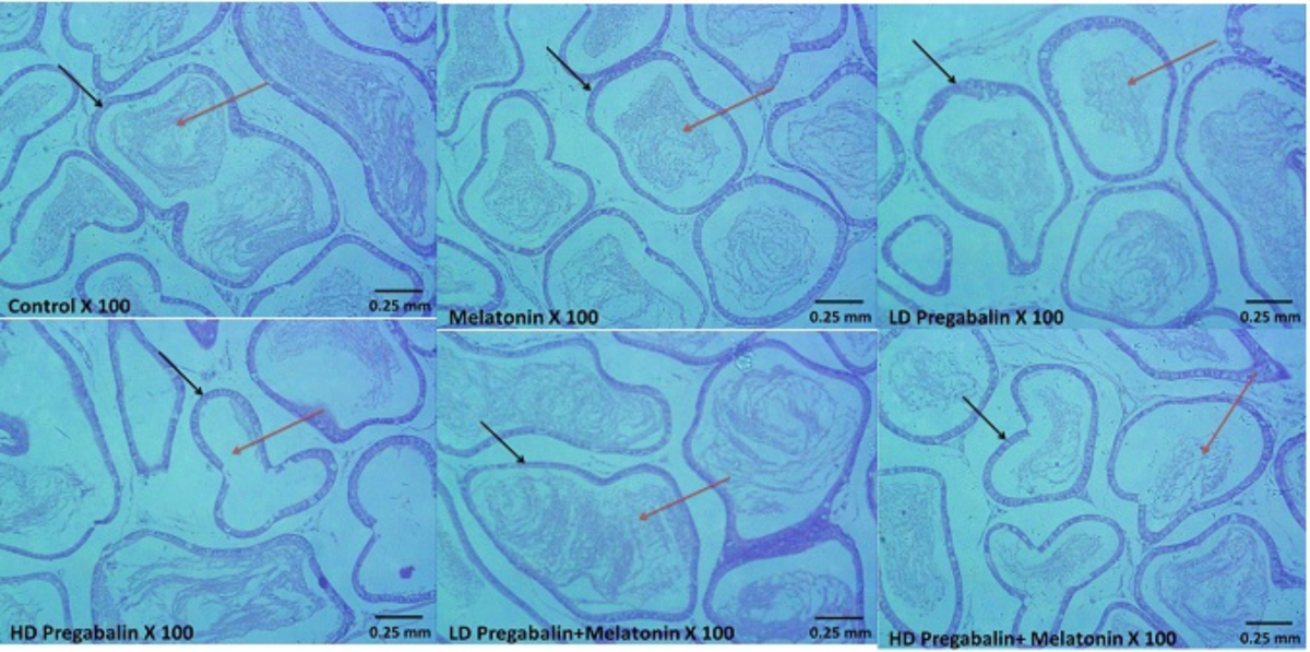 igf-1 lr3 efectos secundarios IGF-1 LR3 Receptor Grade 1mg Research Peptide